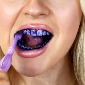 blanchisseur des dents